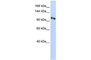 SMG5 antibody used at 1 ug/ml to detect target protein. (SMG5 抗体)