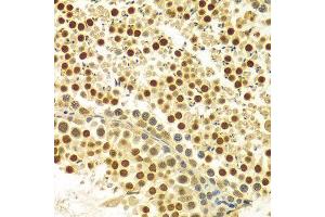 Immunohistochemistry of paraffin-embedded Rat testis using MYSM1 antibody at dilution of 1:100 (x400 lens). (MYSM1 抗体  (C-Term))