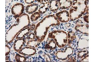 Immunohistochemical staining of paraffin-embedded Human Kidney tissue using anti-MMAB mouse monoclonal antibody. (MMAB 抗体)