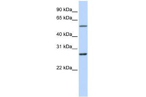 RNF217 antibody used at 1 ug/ml to detect target protein. (RNF217 抗体  (Middle Region))