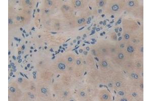 Detection of PIK3C3 in Human Liver Tissue using Polyclonal Antibody to Phosphoinositide-3-Kinase Class 3 (PIK3C3) (PIK3C3 抗体  (AA 631-885))