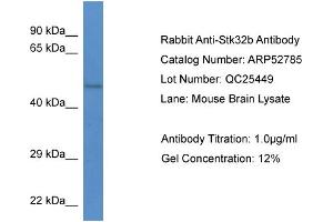 Western Blotting (WB) image for anti-serine/threonine Kinase 32B (STK32B) (N-Term) antibody (ABIN2785092)