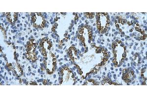 Rabbit Anti-KRT8 Antibody       Paraffin Embedded Tissue:  Human alveolar cell   Cellular Data:  Epithelial cells of renal tubule  Antibody Concentration:   4. (KRT8 抗体  (N-Term))
