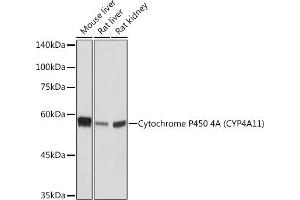 Western blot analysis of extracts of various cell lines, using Cytochrome P450 4A (CYP4) (CYP4) Rabbit mAb (ABIN7266658) at 1:1000 dilution. (CYP4A11 抗体)