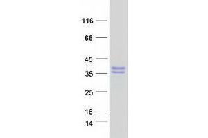 Western Blotting (WB) image for Melanoma Antigen Family H, 1 (MAGEH1) protein (Myc-DYKDDDDK Tag) (ABIN2725220)