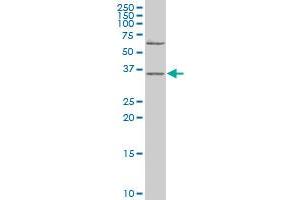 DFFB polyclonal antibody (A01), Lot # 050928JC01.