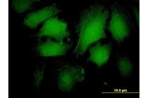 Immunofluorescence of monoclonal antibody to ARRB2 on HeLa cell. (Arrestin 3 抗体  (AA 300-409))