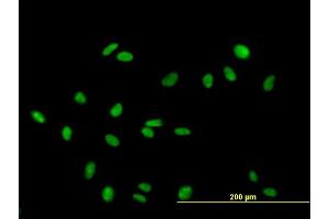 Immunofluorescence of purified MaxPab antibody to RAD18 on HeLa cell. (RAD18 抗体  (AA 1-495))