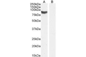 ABIN5539909 (1µg/ml) staining of Rat Testes lysate (A) + Peptide (B) (35µg protein in RIPA buffer). (STRA6 抗体  (C-Term))