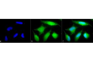 Immunocytochemistry (ICC) image for anti-RAB5A, Member RAS Oncogene Family (RAB5A) antibody (ABIN361846)