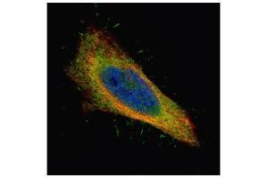 ICC/IF Image Confocal immunofluorescence analysis (Olympus FV10i) of paraformaldehyde-fixed HeLa, using Filamin B, antibody (Green) at 1:500 dilution. (FLNB 抗体  (N-Term))