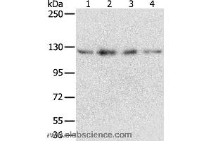 Western blot analysis of Huvec, hepg2, 293T and A549 cell, using RBM5 Polyclonal Antibody at dilution of 1:500 (RBM5 抗体)