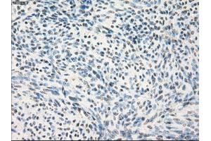 Immunohistochemical staining of paraffin-embedded colon tissue using anti-MAP2K1 mouse monoclonal antibody. (MEK1 抗体)