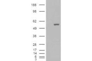 HEK293 overexpressing ALDH1A1 (ABIN5493687) and probed with ABIN184581 (mock transfection in first lane). (ALDH1A1 抗体  (C-Term))