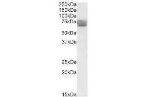 Image no. 1 for anti-Tripeptidyl Peptidase I (TPP1) (Internal Region) antibody (ABIN401515) (TPP1 抗体  (Internal Region))