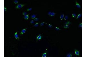 Immunofluorescence (IF) image for anti-Transmembrane Protein 165 (TMEM165) (AA 173-228) antibody (ABIN7173091)