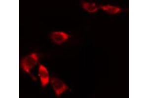 ABIN6274825 staining HuvEc cells by IF/ICC. (ALDH3B1 抗体  (N-Term))