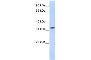 WB Suggested Anti-SIAH2 Antibody Titration: 0. (SIAH2 抗体  (N-Term))