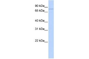 WB Suggested Anti-ZBTB39 Antibody Titration:  0. (ZBTB39 抗体  (Middle Region))