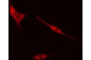 ABIN6274299 staining Hela cells by IF/ICC. (COPS2 抗体  (Internal Region))