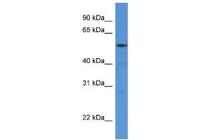 WB Suggested Anti-HARS AntibodyTitration: 1. (HARS1/Jo-1 抗体  (N-Term))