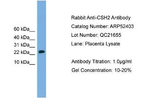 WB Suggested Anti-CSH2  Antibody Titration: 0. (CSH1 抗体  (Middle Region))