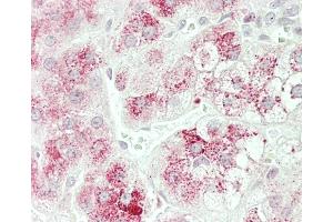 Immunohistochemistry (Paraffin-embedded Sections) (IHC (p)) image for anti-Carboxypeptidase M (CPM) (AA 212-241) antibody (ABIN655405)