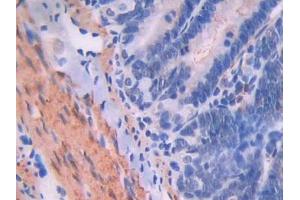 IHC-P analysis of Rat Intestine Tissue, with DAB staining. (Endoglin 抗体  (AA 26-136))