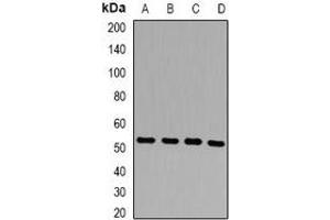 Western blot analysis of Presenilin 2 expression in HepG2 (A), Hela (B), mouse liver (C), rat liver (D) whole cell lysates.