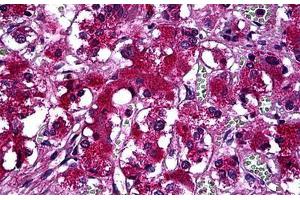Human Adrenal: Formalin-Fixed, Paraffin-Embedded (FFPE) (SYT1 抗体  (AA 1-423))