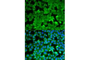 Immunofluorescence analysis of A549 cells using ASNS antibody. (Asparagine Synthetase 抗体)