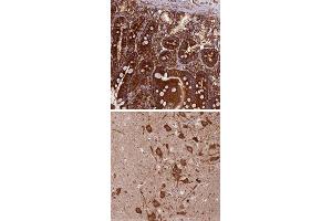 Immunohistochemical staining of human hippocampus with KARS polyclonal antibody  shows strong cytoplasmic positivity in neuronal cells at 1:50-1:200 dilution. (KARS 抗体)