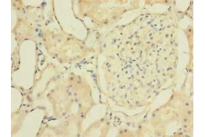Immunohistochemistry of paraffin-embedded human kidney tissue using ABIN7176509 at dilution of 1:100 (ZNF77 抗体  (AA 51-369))