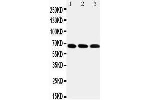 Anti-IRAKM antibody,  Western blotting Lane 1: HELA Cell Lysate Lane 2: JURKAT Cell Lysate Lane 3: HUT102 Cell Lysate (IRAK3 抗体  (C-Term))