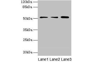 Western blot All lanes: ACSBG2 antibody at 4 μg/mL Lane 1: A431 whole cell lysate Lane 2: K562 whole cell lysate Lane 3: A549 whole cell lysate Secondary Goat polyclonal to rabbit IgG at 1/10000 dilution Predicted band size: 75, 69, 54, 52 kDa Observed band size: 52 kDa (ACSBG2 抗体  (AA 301-600))