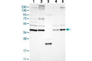 Western blot analysis of Lane 1: RT-4, Lane 2: U-251 MG, Lane 3: Human Plasma, Lane 4: Liver, Lane 5: Tonsil with FRYL polyclonal antibody  at 1:250-1:500 dilution. (FRY-Like 抗体)