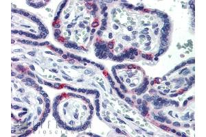 SIN3A antibody was used for immunohistochemistry at a concentration of 5. (SIN3A 抗体  (N-Term))