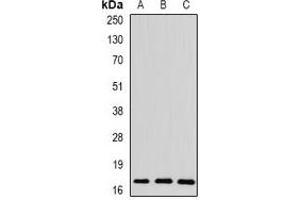 Western blot analysis of Spot 14 expression in mouse liver (A), rat brain (B), rat heart (C) whole cell lysates. (THRSP 抗体)