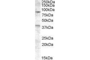 Western Blotting (WB) image for Exonuclease 1 (EXO1) peptide (ABIN369203) (Exonuclease 1 (EXO1) Peptide)