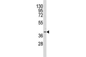 Western blot analysis of AKR1A1 antibody and Y79 lysate (AKR1A1 抗体  (AA 293-325))