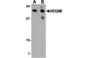 WB Image for AP22614PU-N Western blot analysis of IRGM in human brain lysate with IRGM antibody at (A) 1 and (B) 2 µg/ml. (IRGM 抗体  (Center))