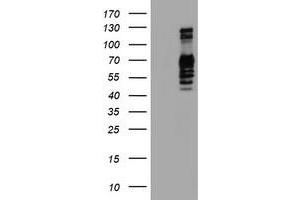Western Blotting (WB) image for anti-Golgi Membrane Protein 1 (GOLM1) antibody (ABIN1498493) (GOLM1 抗体)