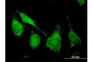 Immunofluorescence of purified MaxPab antibody to CAT on HeLa cell. (Catalase 抗体  (AA 1-527))