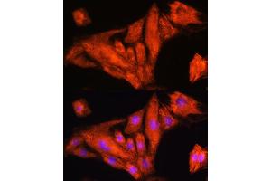 Immunofluorescence analysis of H9C2 cells using Rig-I/DDX58 antibody (ABIN6130263, ABIN6139513, ABIN6139515 and ABIN6217394) at dilution of 1:100. (DDX58 抗体  (AA 726-925))