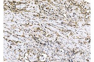IHC analysis of Sigma1-Receptor/SIGMAR1 using anti-Sigma1-Receptor/SIGMAR1 antibody (ABIN7599011).