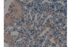 Immunohistochemistry (IHC) image for anti-Sirtuin 3 (SIRT3) (AA 5-257) antibody (ABIN7441238)