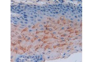 Used in DAB staining on fromalin fixed paraffin- embedded esophagus tissue (SCEL 抗体  (AA 519-685))