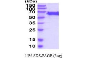 SDS-PAGE (SDS) image for Dopachrome Tautomerase (DCT) (AA 24-472) protein (His tag) (ABIN5854719)