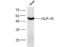 Mouse liver lysates probed with Anti-GLP-1R Polyclonal Antibody, Unconjugated  at 1:5000 for 90 min at 37˚C. (GLP1R 抗体  (AA 101-200))