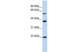 WB Suggested Anti-MYLIP Antibody Titration:  0. (MYLIP 抗体  (Middle Region))